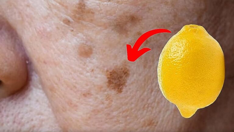 5 skutecznych sposobów na usunięcie plam starczych z cytrynami